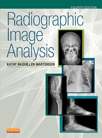Image of Radiographic image analysis