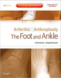 Image of Arthritis & arthroplasty : the foot and ankle