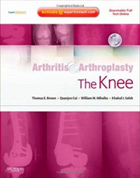 Image of Arthritis & arthroplasty : the knee