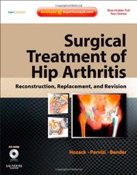 Image of Surgical treatment of hip arthritis : reconstruction, replacement, and revision