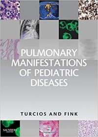 Image of Pulmonary manifestations of pediatric diseases