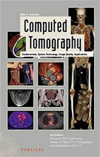 Image of Computed tomography